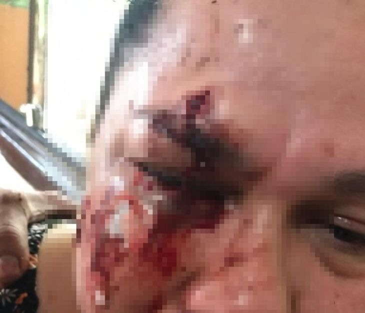 En Presidente Franco piden prisión para sujeto que desfiguró a golpes a su vecina