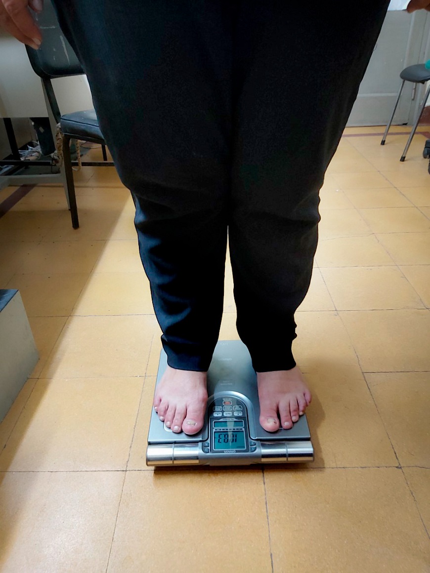 Nutricionistas confirman aumento de casos de obesidad y sus complicaciones
